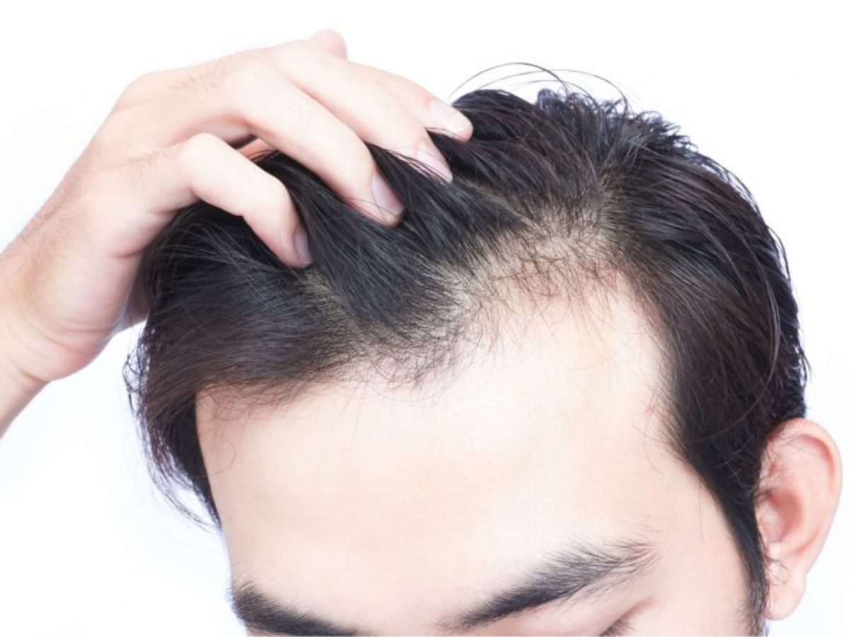 5 Cách làm tóc mọc nhanh dài và dày hơn bằng nguyên liệu tự nhiên   Rungtocvn