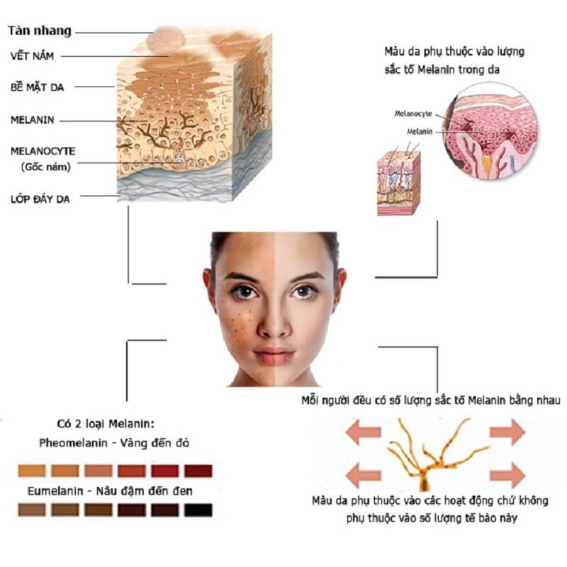 Nguyên nhân của sắc tố da