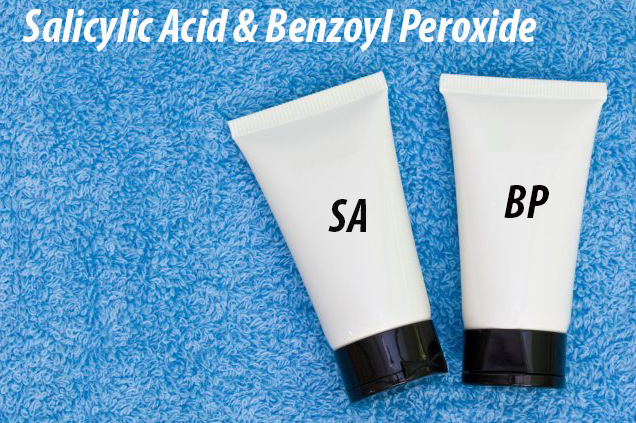 kem trị mụn Salicylic Acid hoặc Benzoyl Peroxide 