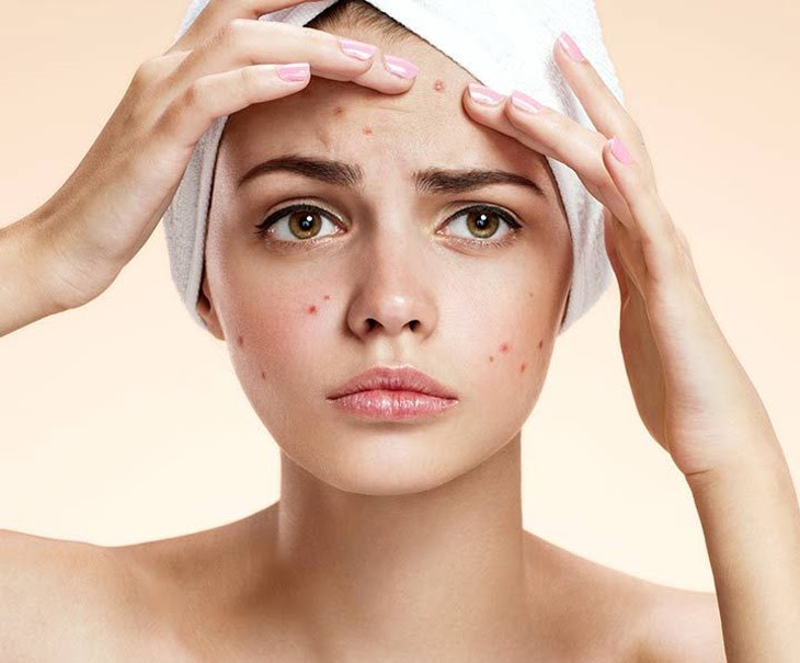 Cách nào làm sạch da mặt dịu nhẹ trước khi trị thâm đỏ sau khi nặn mụn?
