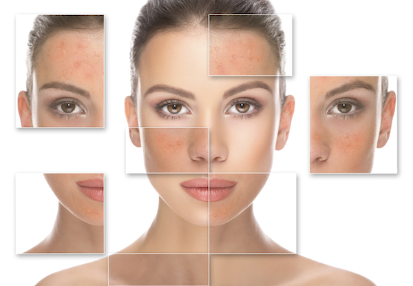 Làm thế nào để phục hồi da mặt bị hư tổn?