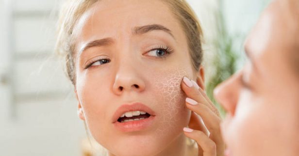 6 Mặt nạ cho da khô nứt nẻ từ nguyên liệu tự nhiên